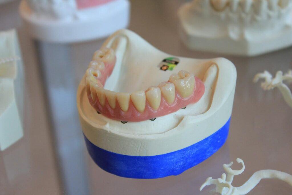 How Much Does It Cost To Get All Your Teeth Redone In Albania?