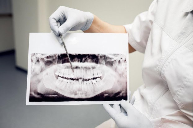 Dentista che esamina un'immagine radiografica dentale, indicando con uno strumento, indossando guanti e camice bianco in una clinica.