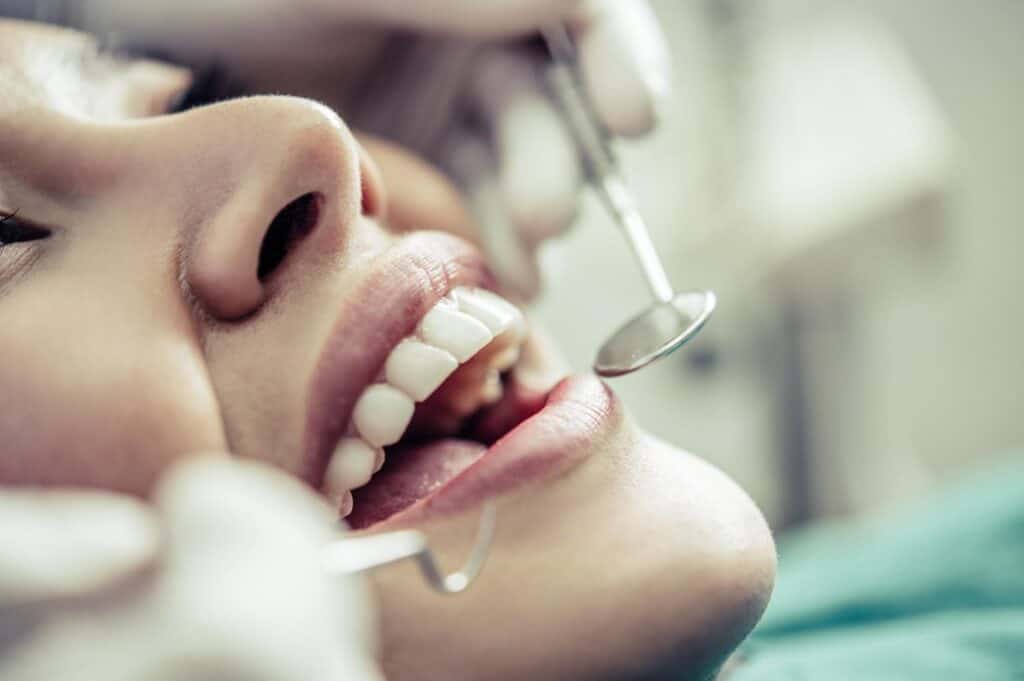 Top 4 Reasons Dental Treatments In Albania Are More Affordable