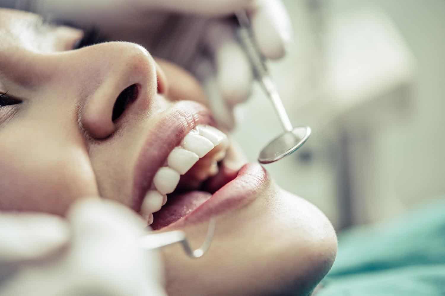 Close-up of a dental check-up with a dentist examining teeth using a dental mirror.