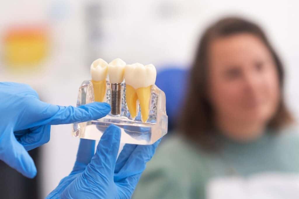 Odontoiatra che spiega al paziente il modello di impianto dentale.