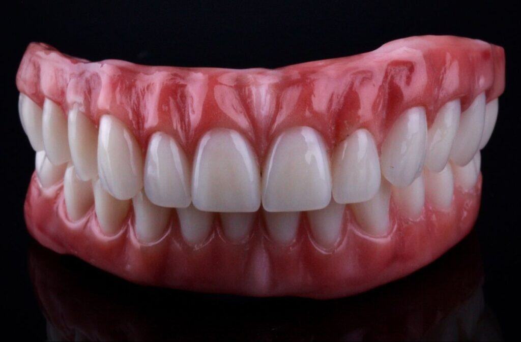 From Italy To Tirana: Why Smart Patients Choose Albania For Full-Mouth Implants