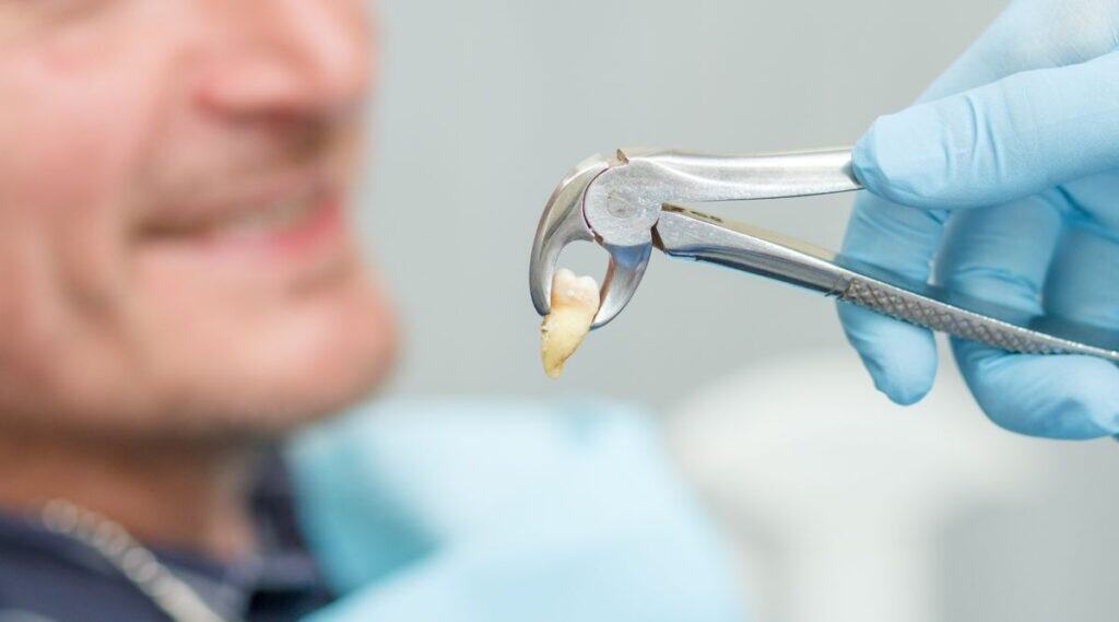 Dentist holding extracted tooth with forceps, patient smiling in background.