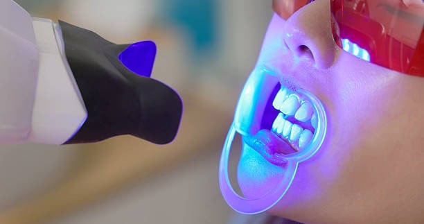 Person receiving dental whitening treatment with blue LED light, wearing protective eyewear and mouth guard.