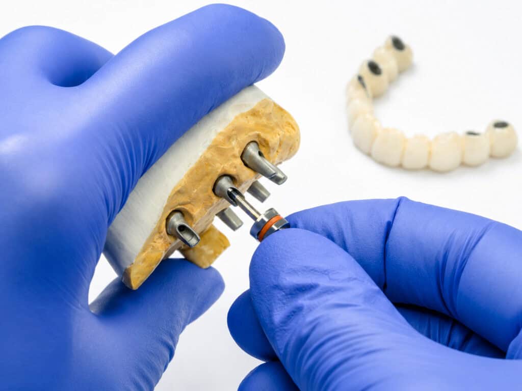 Dental examination on tablet showing teeth alignment at modern clinic.