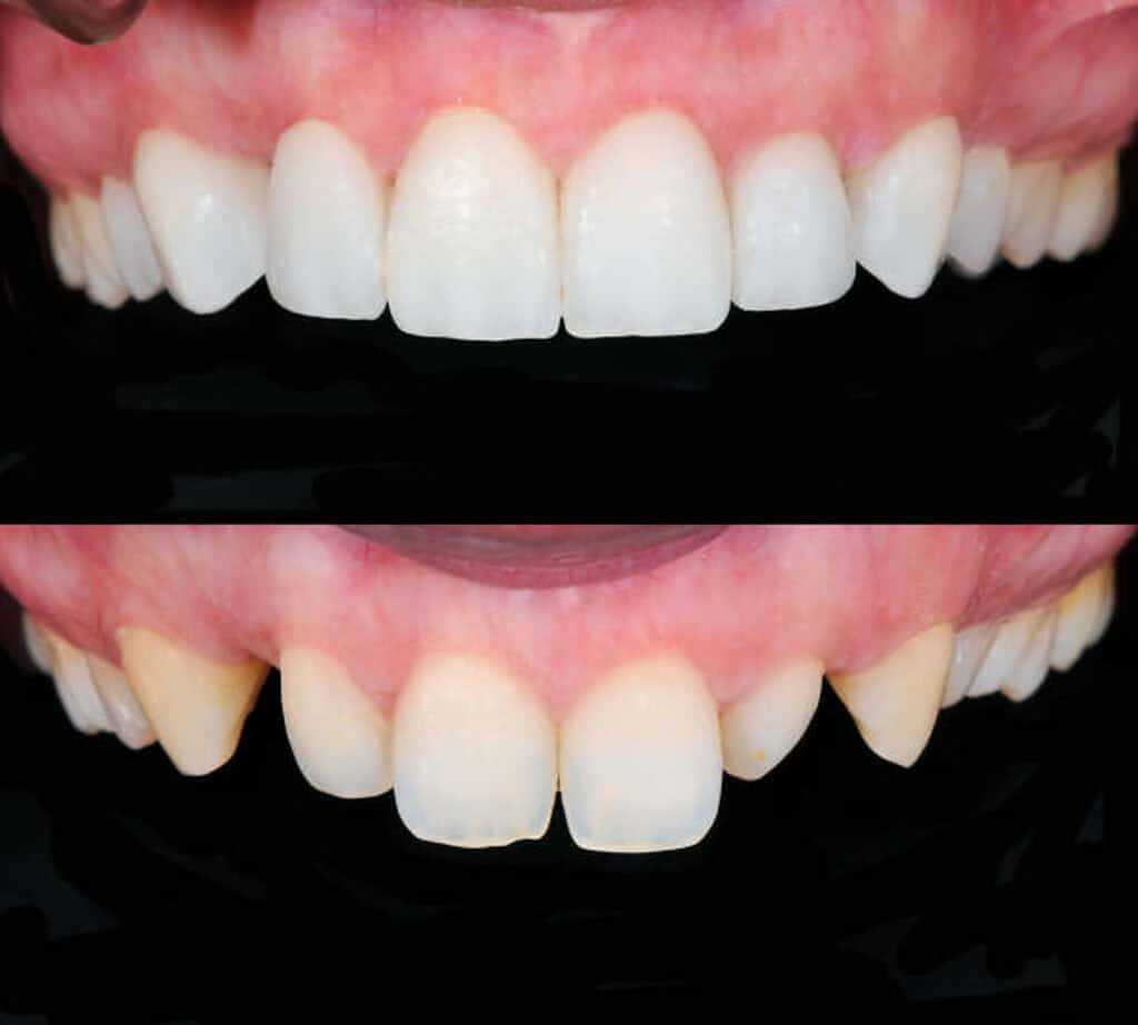 Person receiving a dental CT scan, smiling during the 3D imaging procedure in a modern dental clinic.
