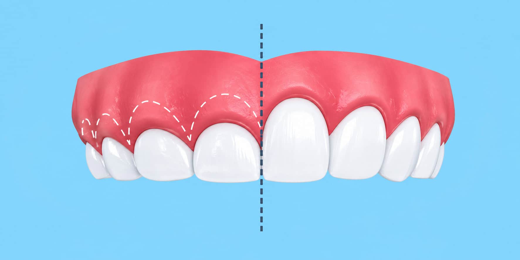 Woman smiling during panoramic dental X-ray in a modern dental clinic.