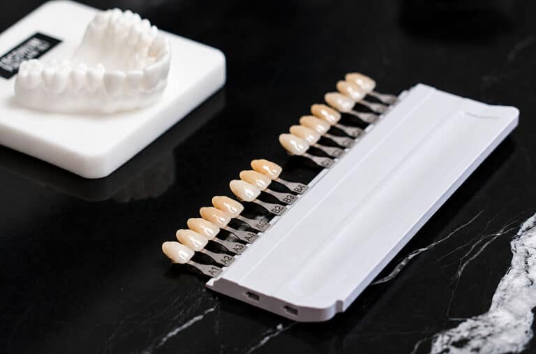 Full Set Of Veneers: How Many Teeth Should Actually Be Treated?