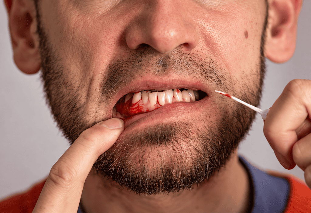 Close-up of a person with bleeding gums while flossing, highlighting dental hygiene and oral health care issues.